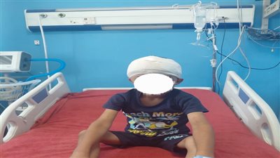 رئيس جامعة سوهاج يعلن نجاح استخراج رصاصة طائشة من مخ طفل.. تفاصيل