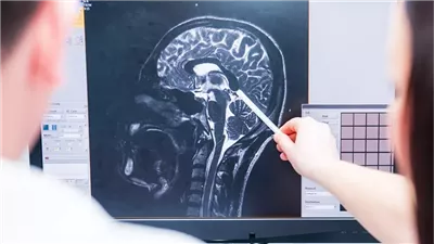 دراسة.. الدماغ البشري غير مهيأ للحياة العصرية