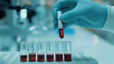 قبل سنوات من التشخيص.. تغيرات بالدم مرتبطة بتلوث الهواء تنذر بسرطان الرئة 